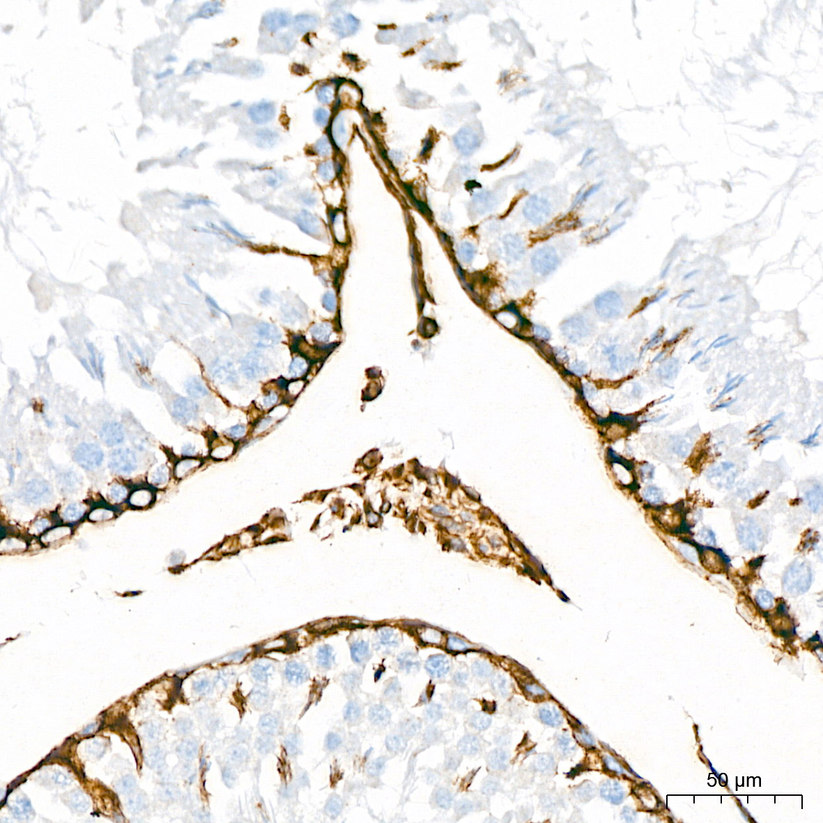 [KD Validated] Vimentin Rabbit mAb