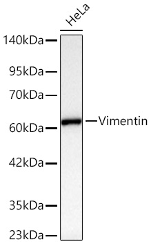 [KD Validated] Vimentin Rabbit mAb