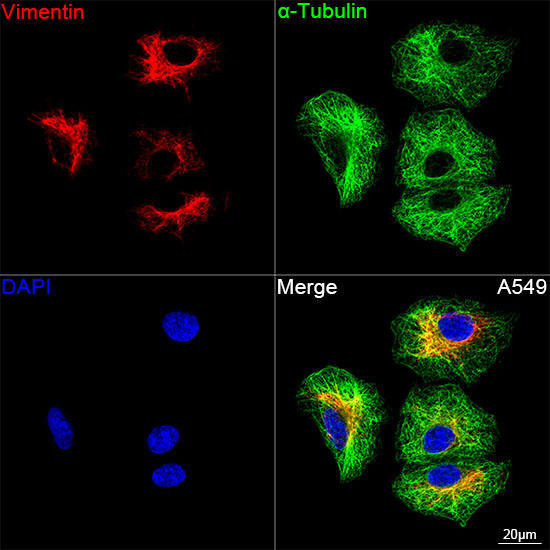 [KD Validated] Vimentin Rabbit mAb