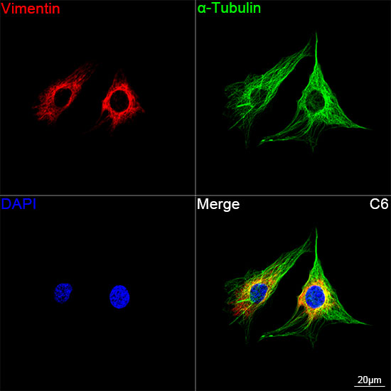 [KD Validated] Vimentin Rabbit mAb