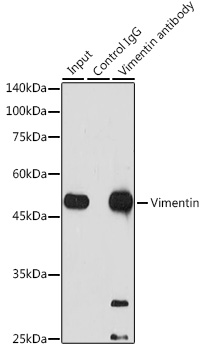 [KD Validated] Vimentin Rabbit mAb