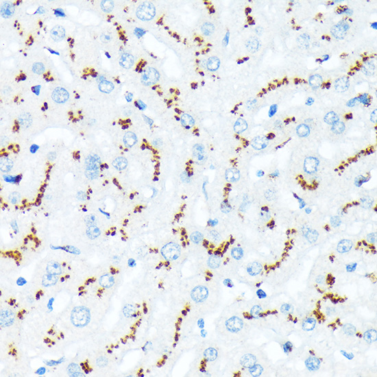 TGN46/TGOLN2 Rabbit mAb