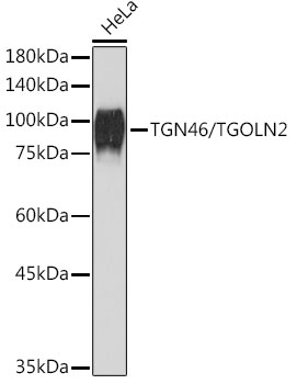 TGN46/TGOLN2 Rabbit mAb