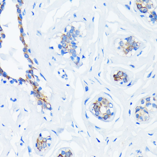 HRAS Rabbit mAb