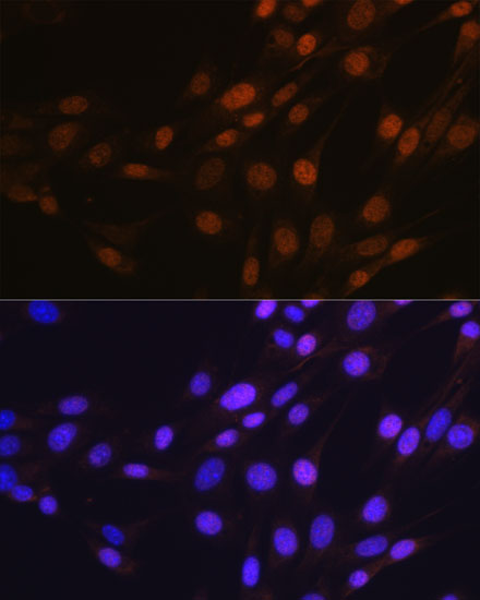 SP1 Rabbit mAb