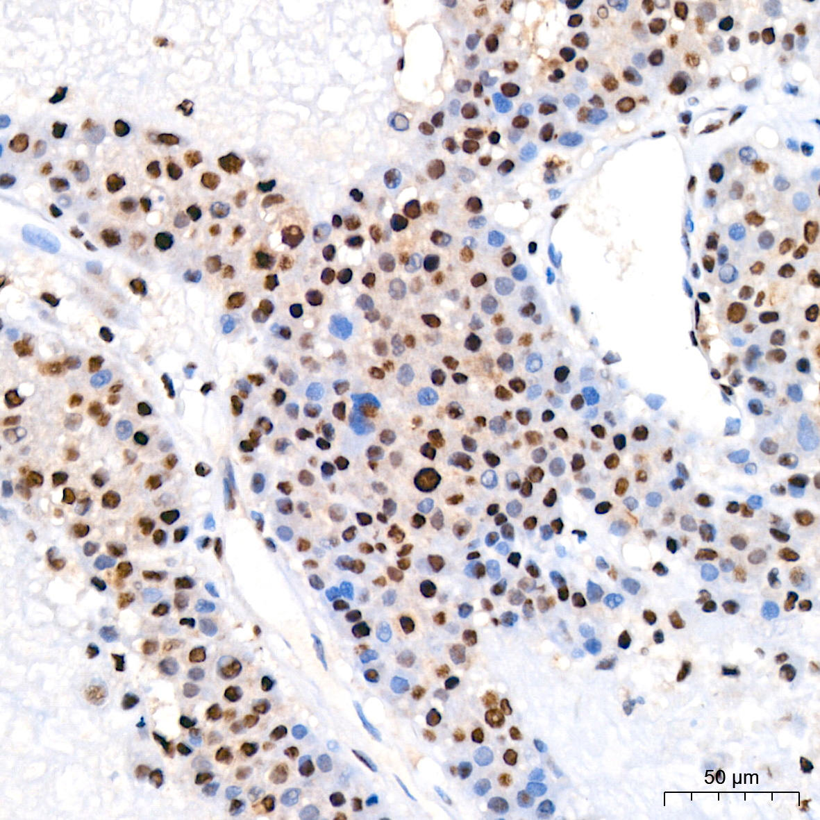 SP1 Rabbit mAb