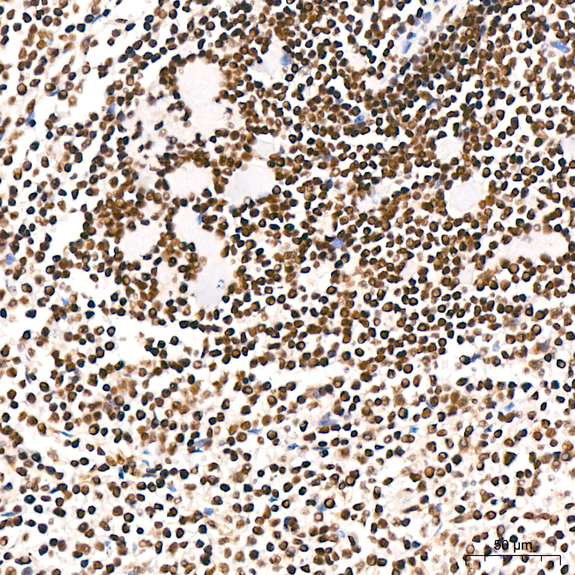 SP1 Rabbit mAb