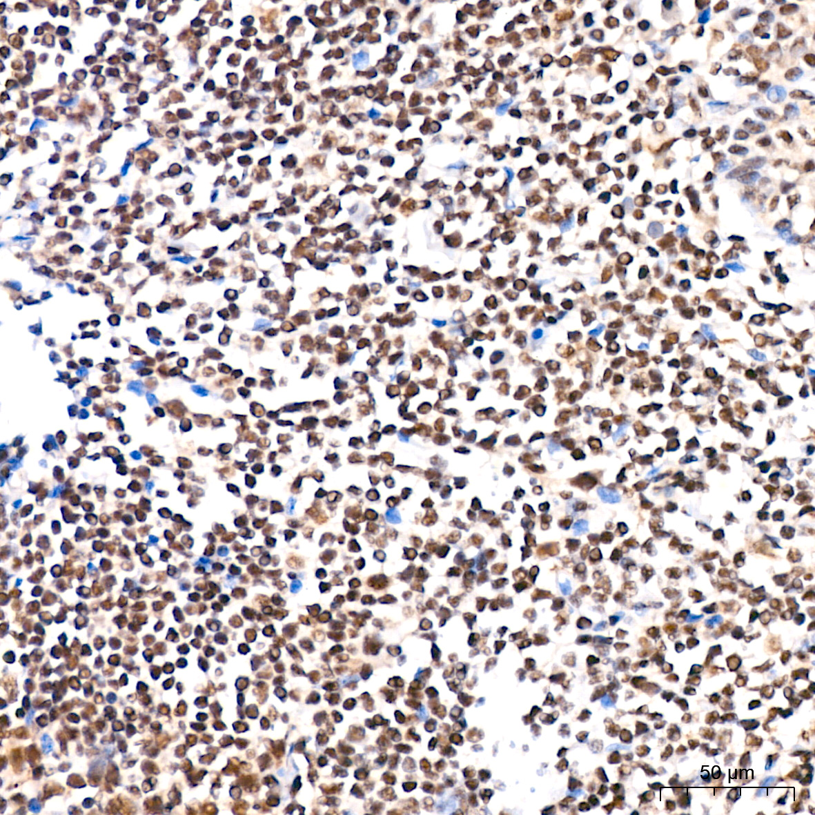 SP1 Rabbit mAb