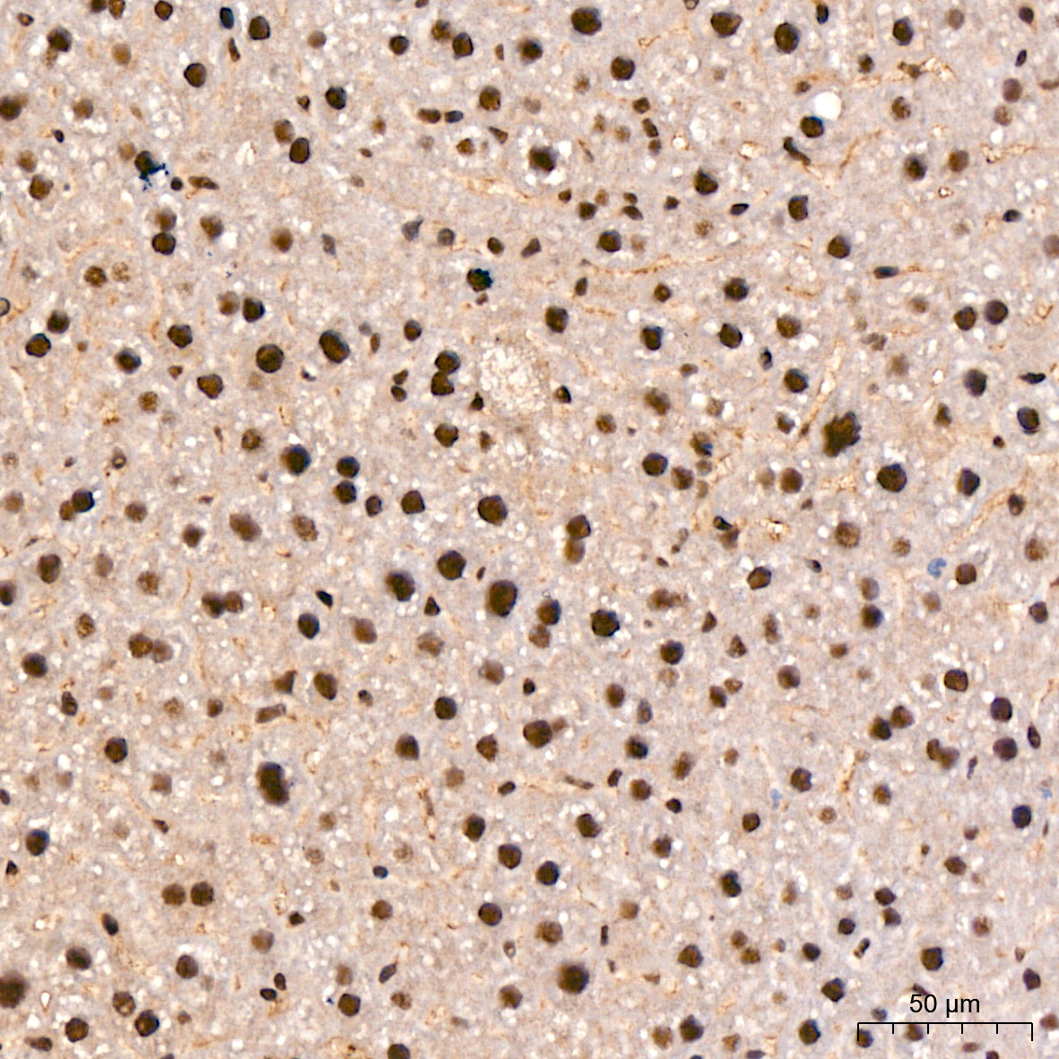 SP1 Rabbit mAb