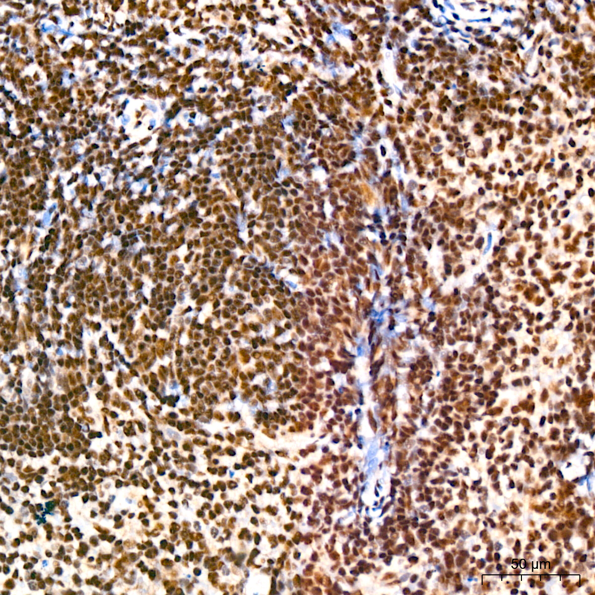 SP1 Rabbit mAb