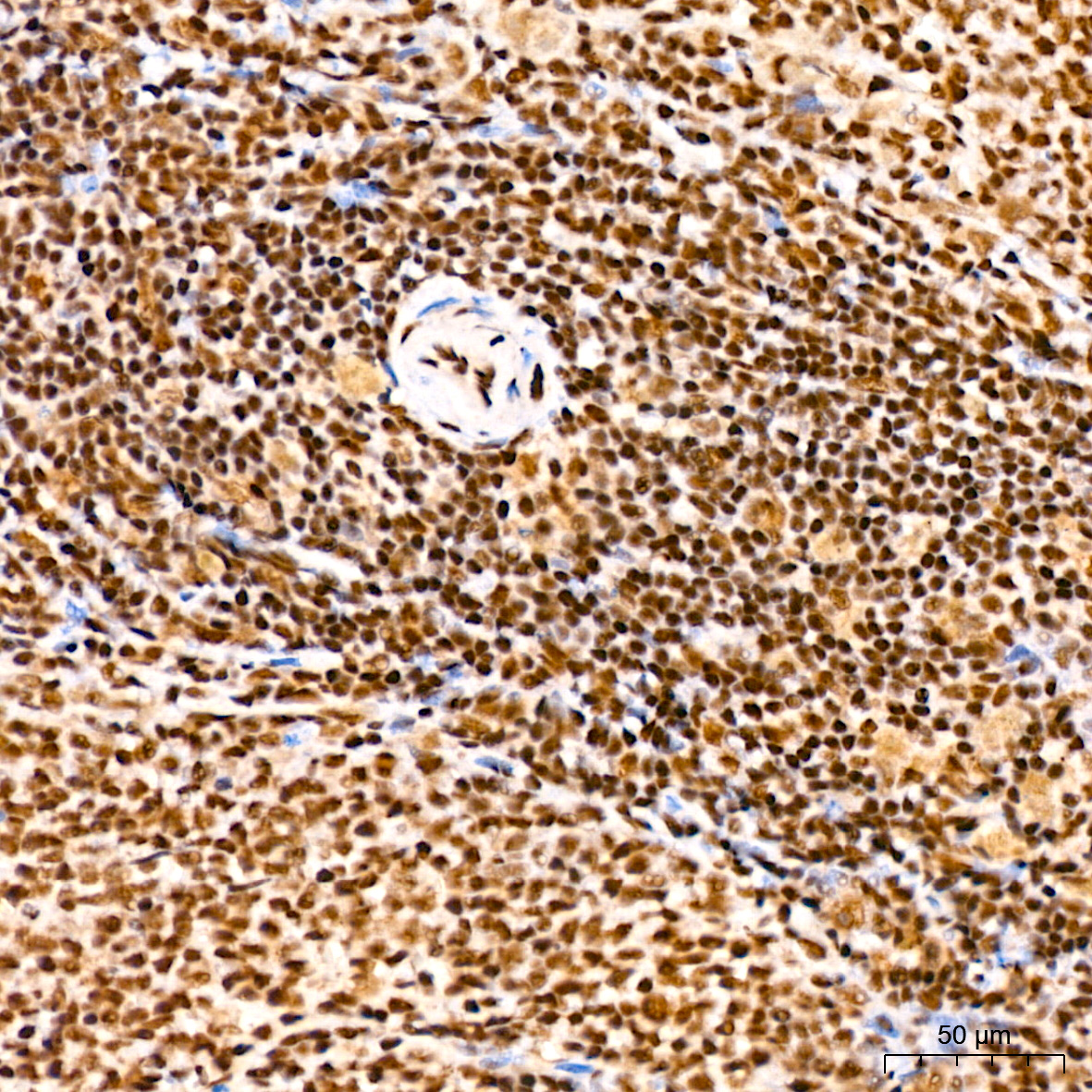 SP1 Rabbit mAb
