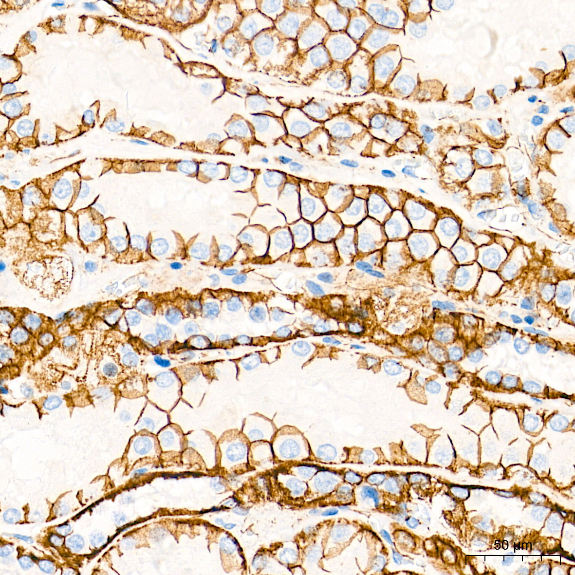 [KO Validated] β-Catenin Rabbit mAb