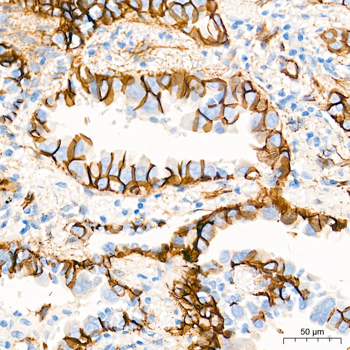 [KO Validated] β-Catenin Rabbit mAb