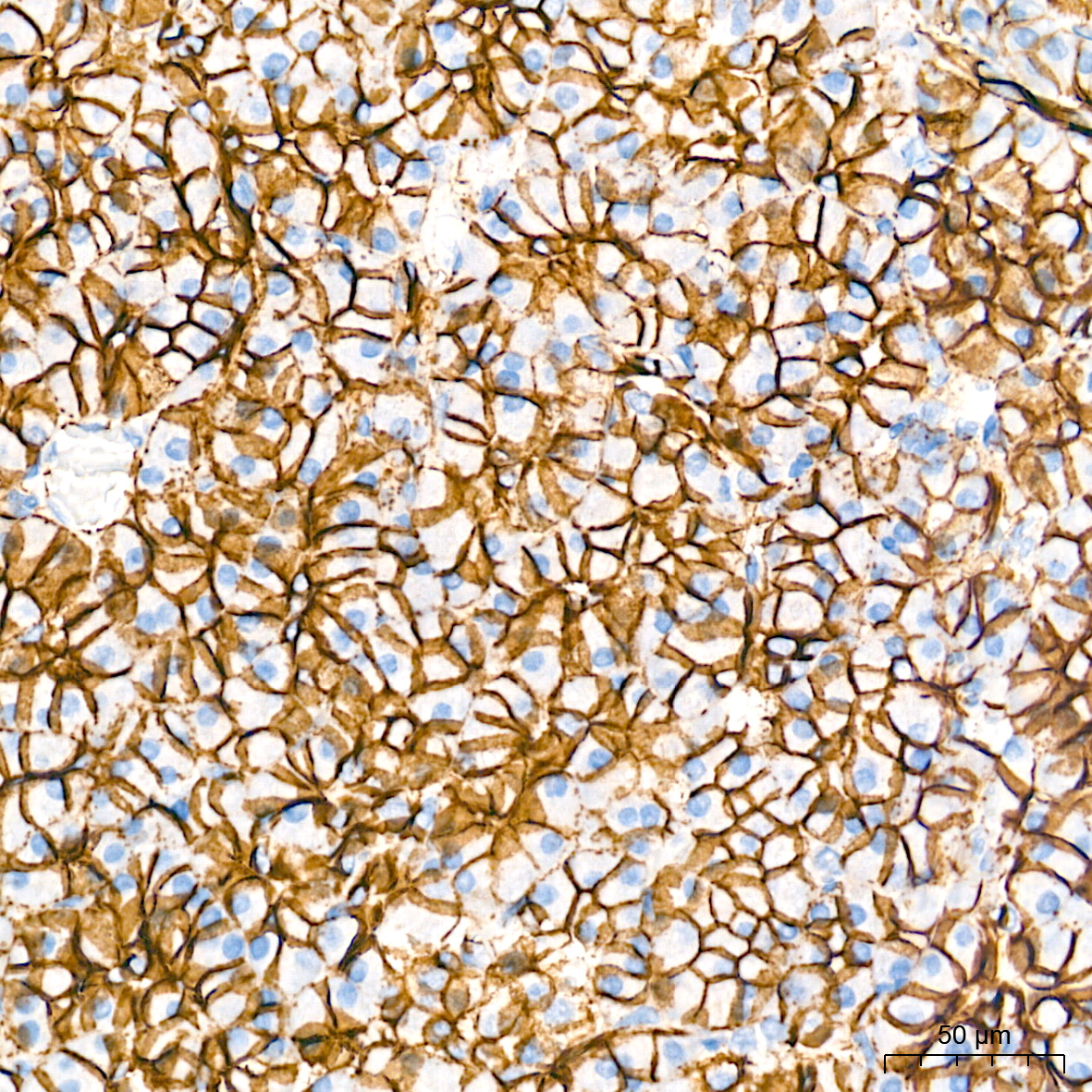 [KO Validated] β-Catenin Rabbit mAb