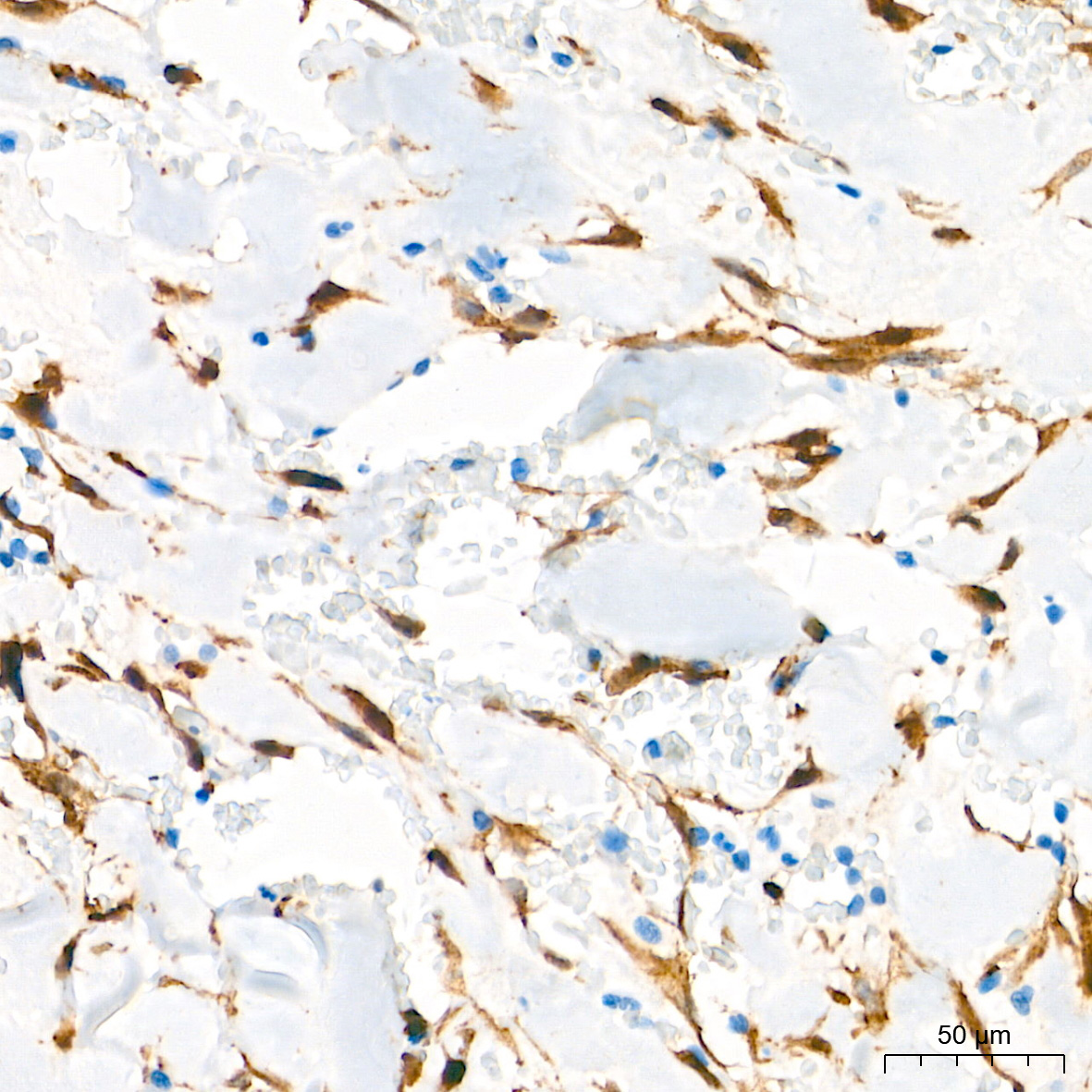 [KO Validated] β-Catenin Rabbit mAb