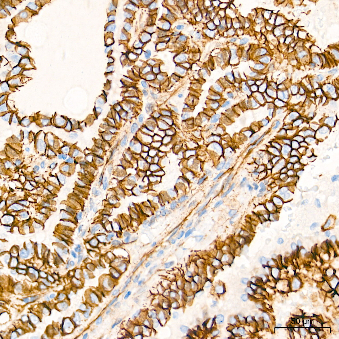 [KO Validated] β-Catenin Rabbit mAb