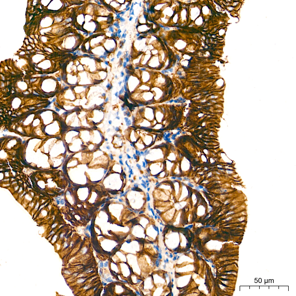 [KO Validated] β-Catenin Rabbit mAb