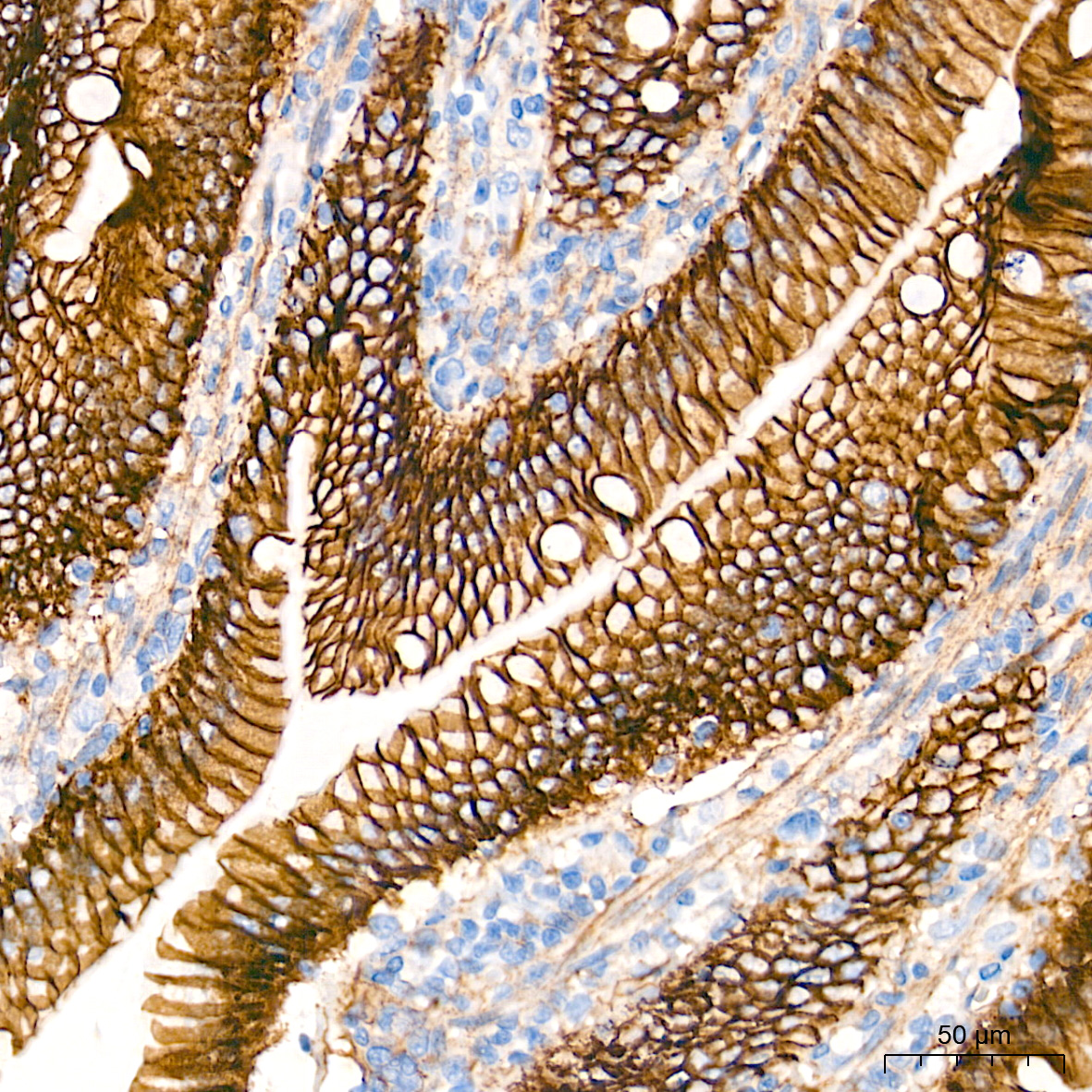 [KO Validated] β-Catenin Rabbit mAb