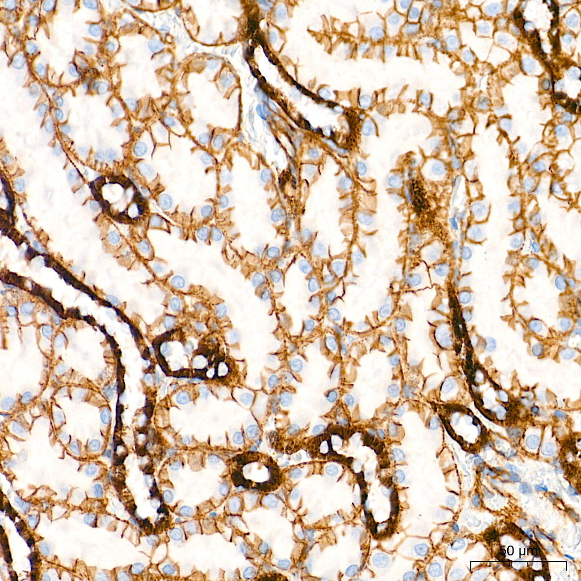 [KO Validated] β-Catenin Rabbit mAb