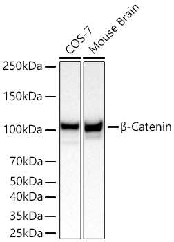 [KO Validated] β-Catenin Rabbit mAb