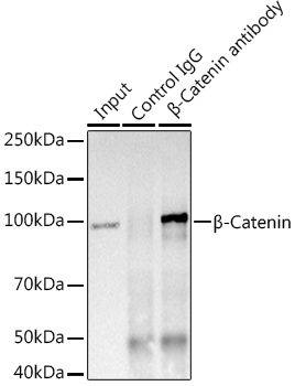 [KO Validated] β-Catenin Rabbit mAb