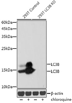 [KD Validated] LC3B Rabbit mAb