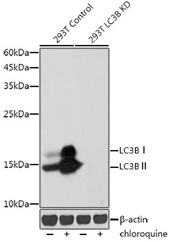 [KD Validated] LC3B Rabbit mAb