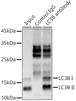 [KD Validated] LC3B Rabbit mAb