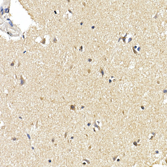 [KD Validated] LC3B Rabbit mAb