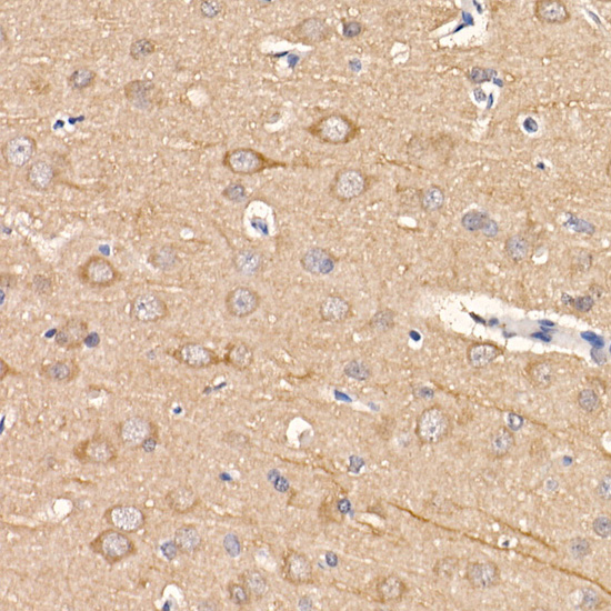 [KD Validated] LC3B Rabbit mAb