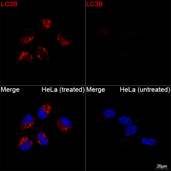 [KD Validated] LC3B Rabbit mAb