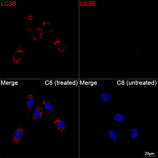[KD Validated] LC3B Rabbit mAb
