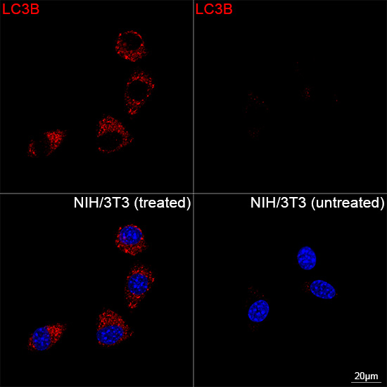 [KD Validated] LC3B Rabbit mAb