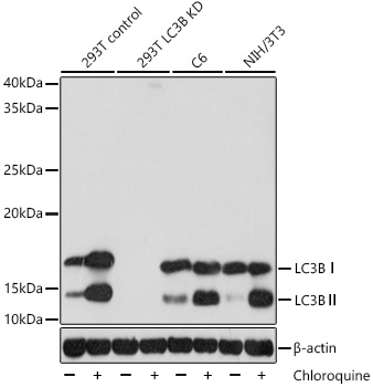 [KD Validated] LC3B Rabbit mAb
