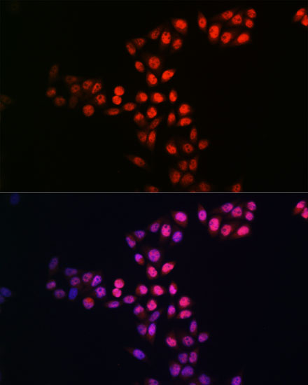 [KO Validated] SIRT1 Rabbit mAb