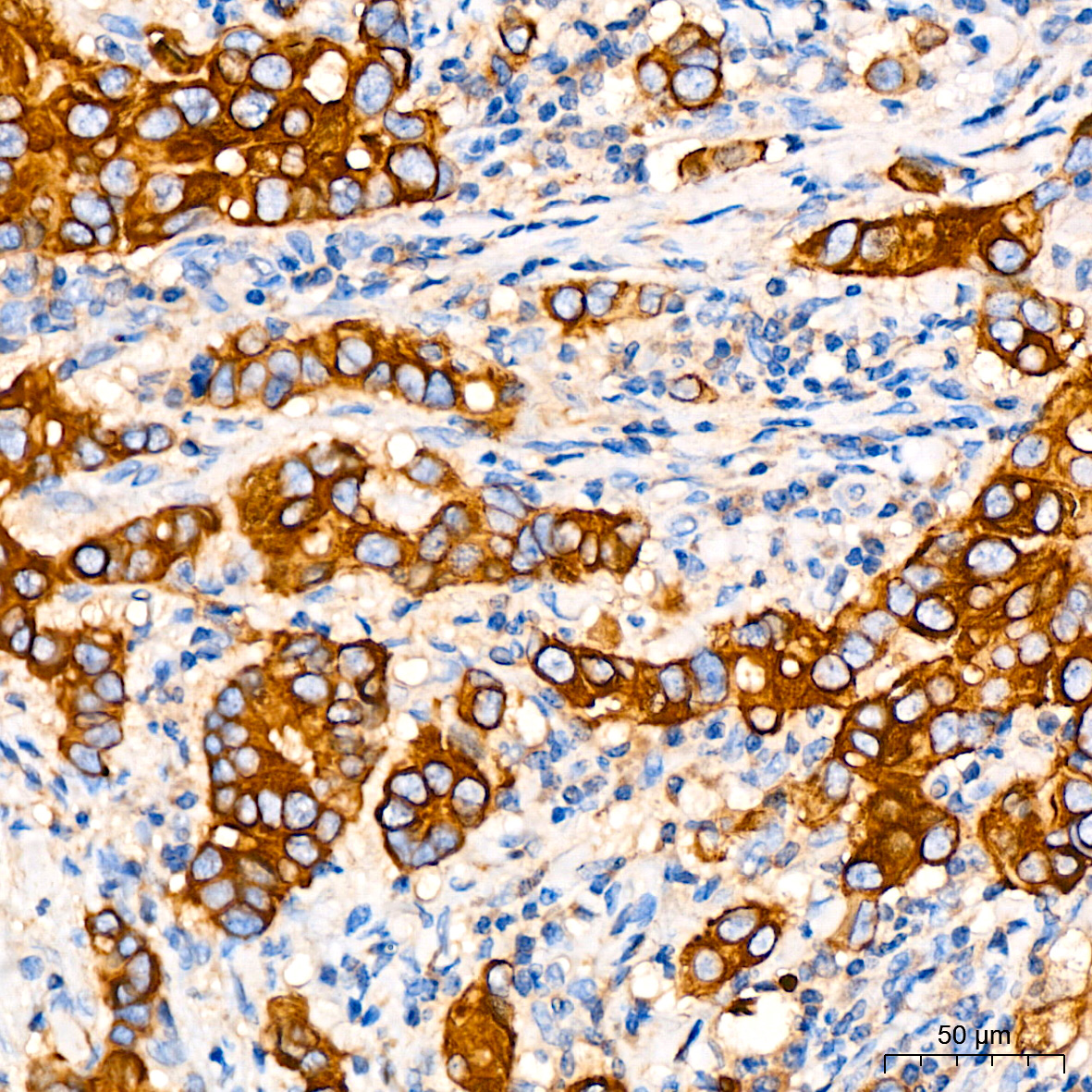 [KO Validated] ATG5 Rabbit mAb