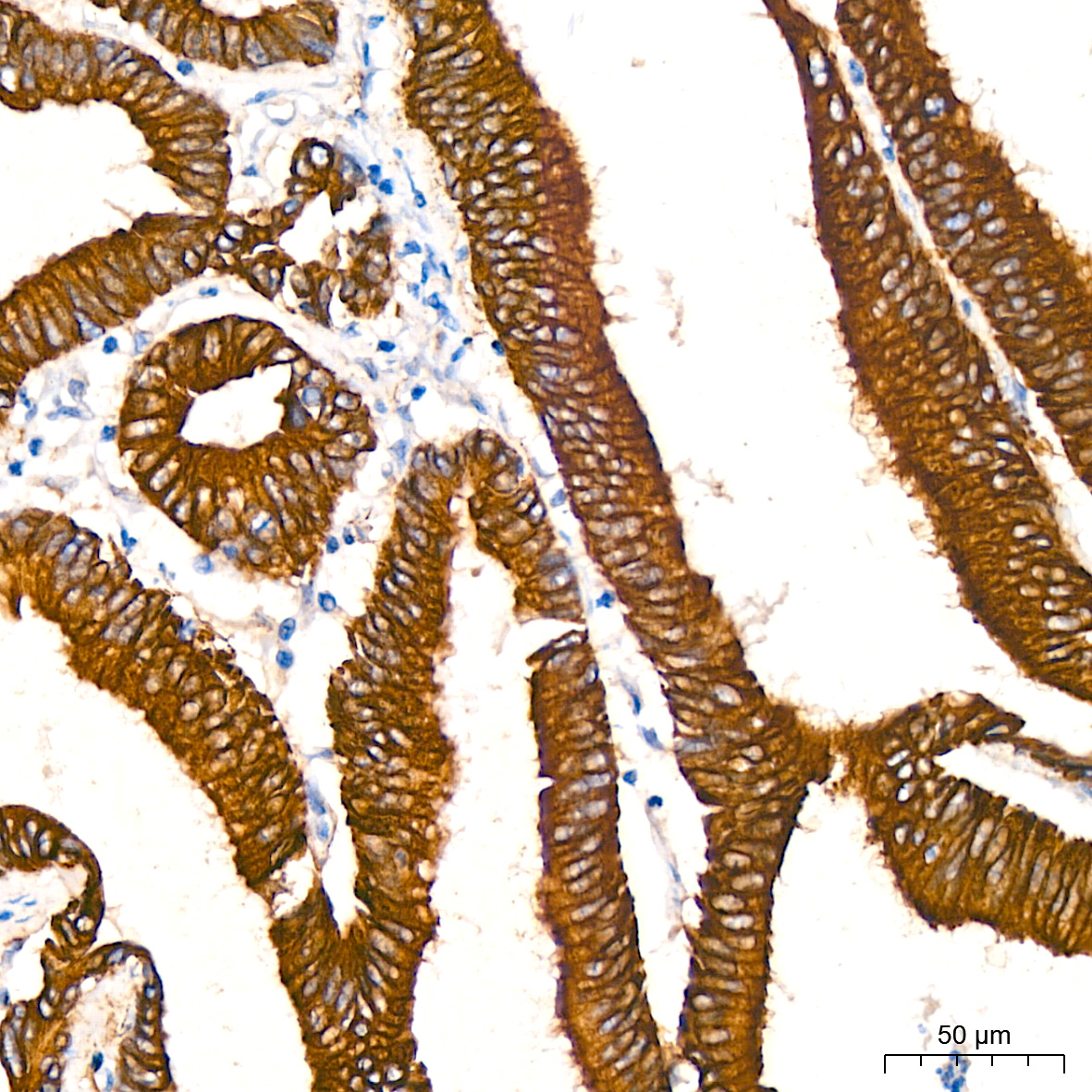 [KO Validated] ATG5 Rabbit mAb