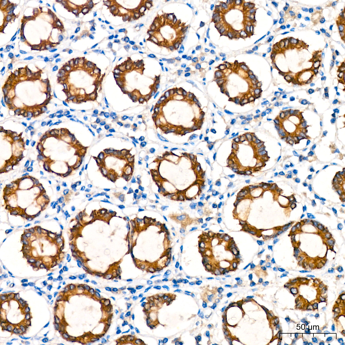 [KO Validated] ATG5 Rabbit mAb