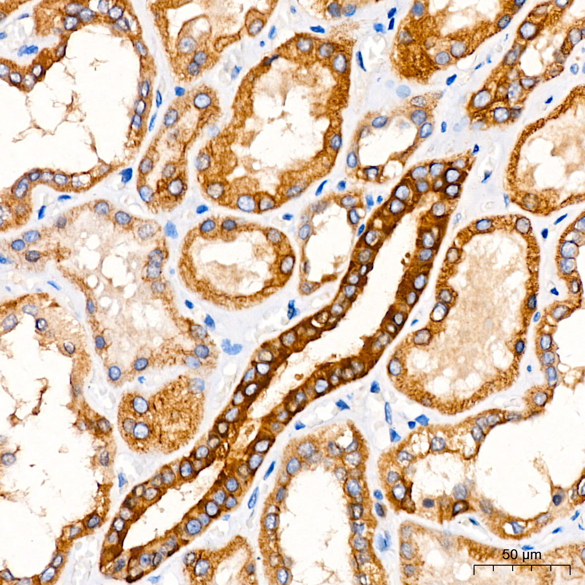 [KO Validated] ATG5 Rabbit mAb