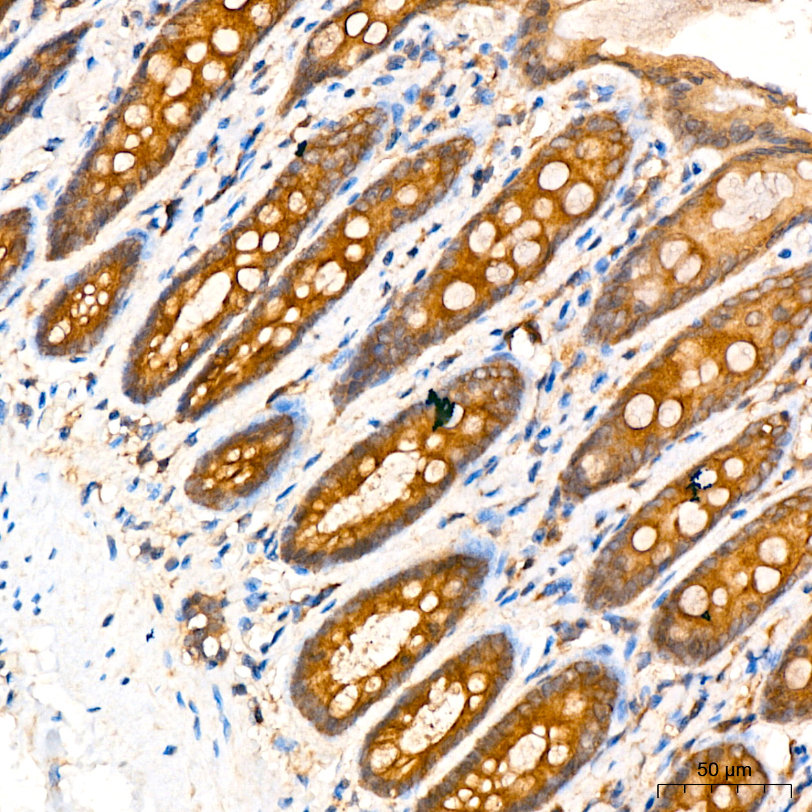 [KO Validated] ATG5 Rabbit mAb