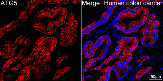 [KO Validated] ATG5 Rabbit mAb