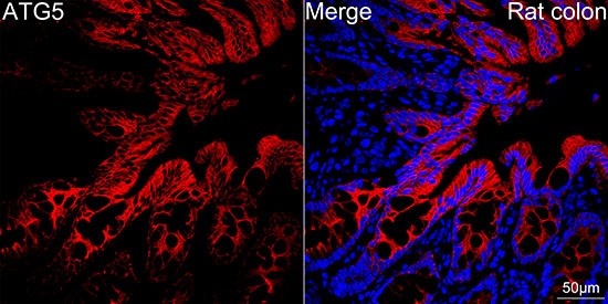 [KO Validated] ATG5 Rabbit mAb