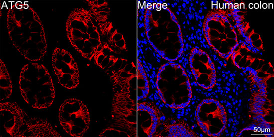[KO Validated] ATG5 Rabbit mAb