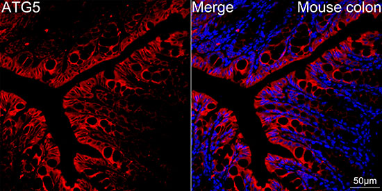 [KO Validated] ATG5 Rabbit mAb