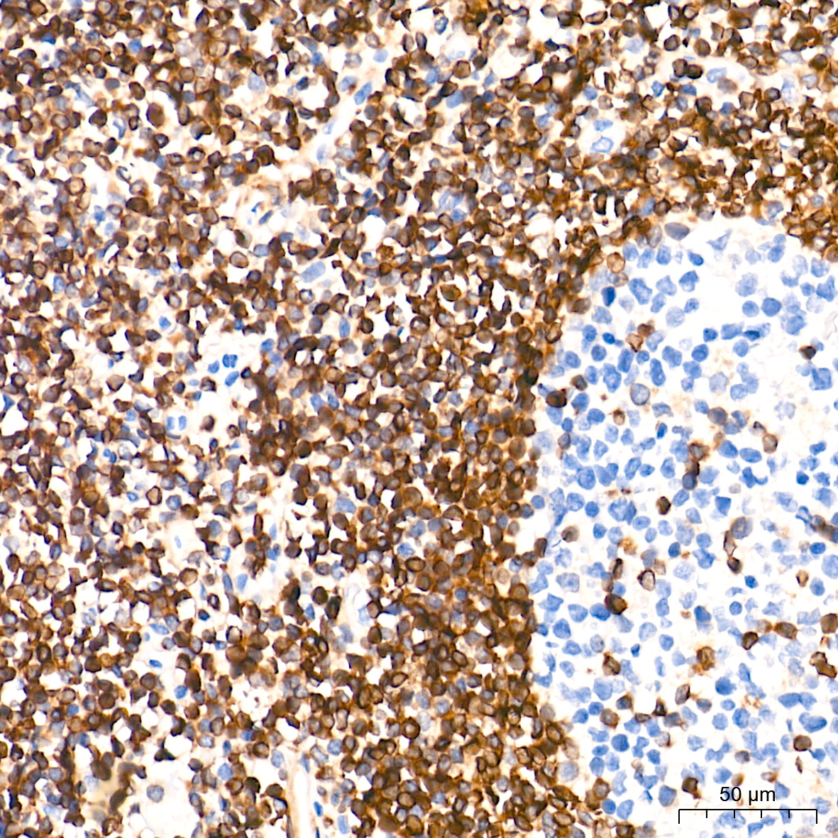 Bcl-2 Rabbit mAb