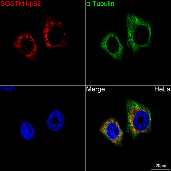 SQSTM1/p62 Rabbit mAb