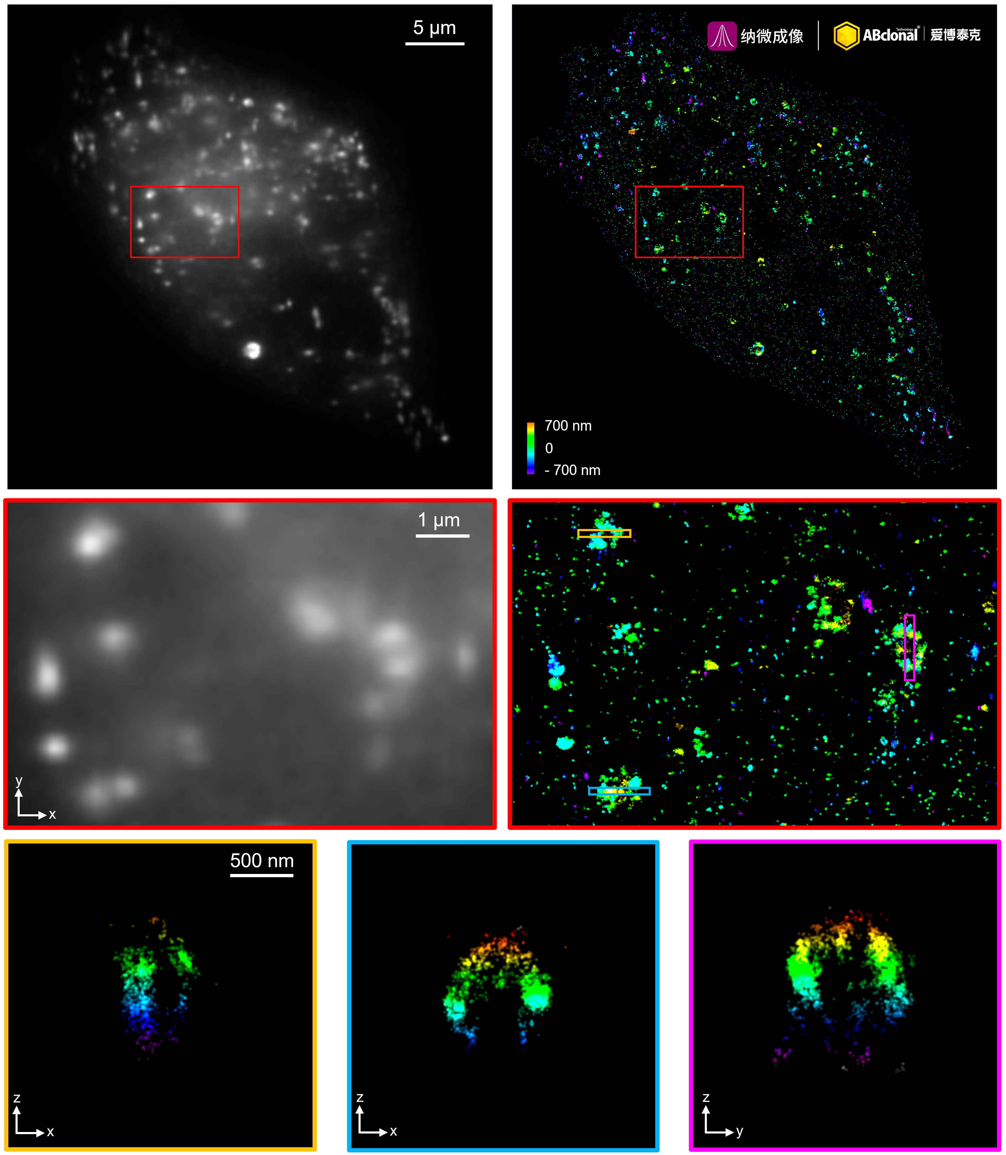 SQSTM1/p62 Rabbit mAb