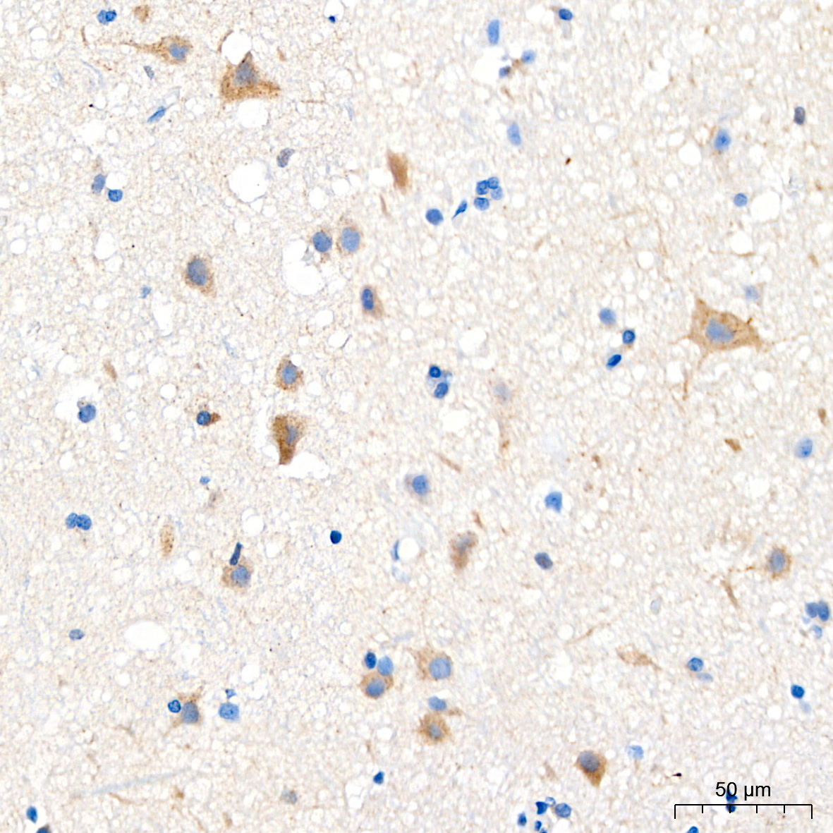 SQSTM1/p62 Rabbit mAb