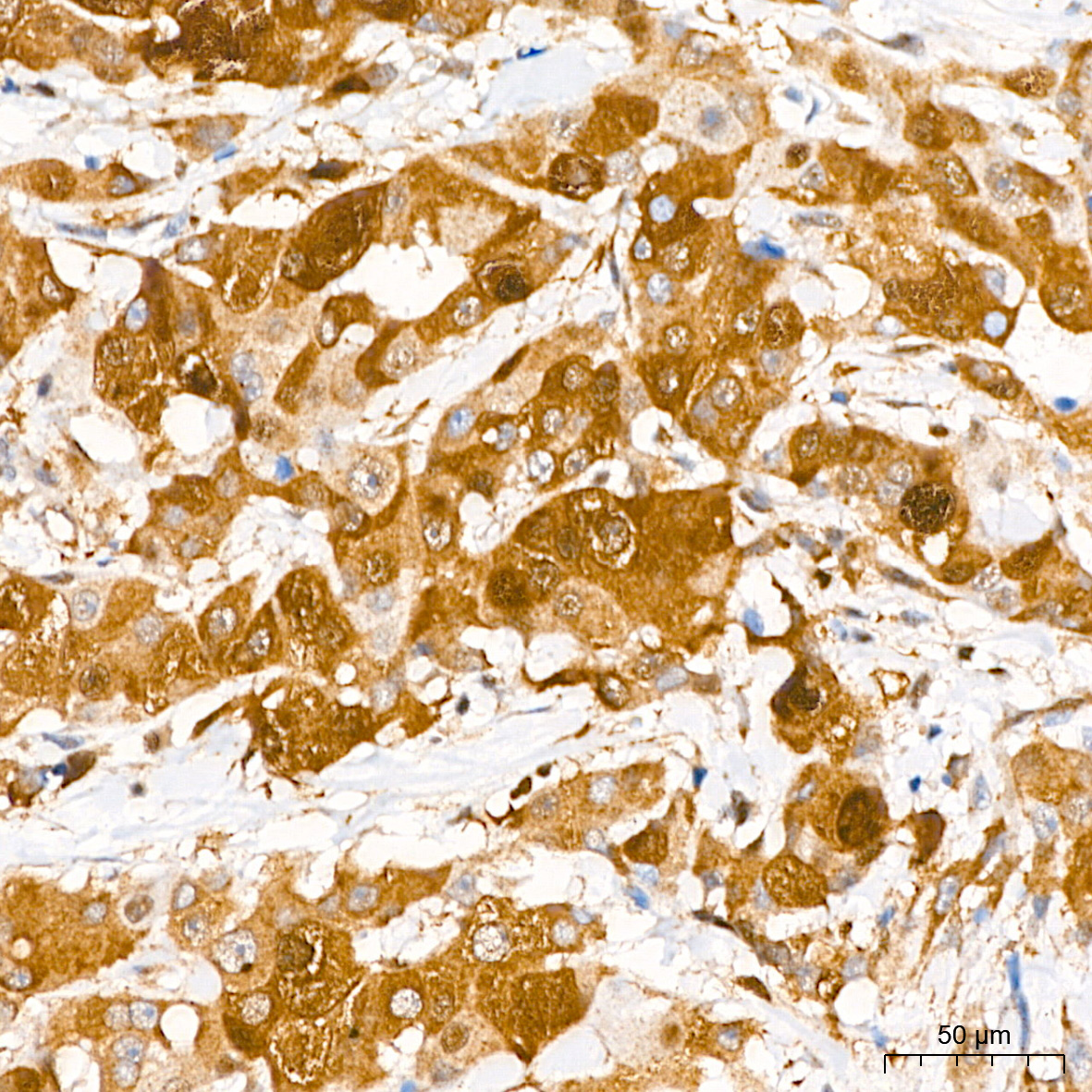 SQSTM1/p62 Rabbit mAb