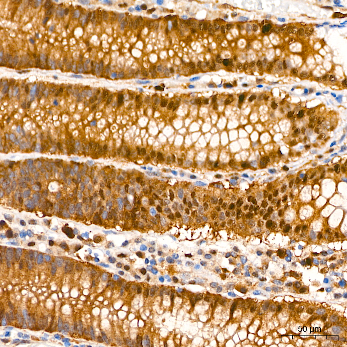 SQSTM1/p62 Rabbit mAb